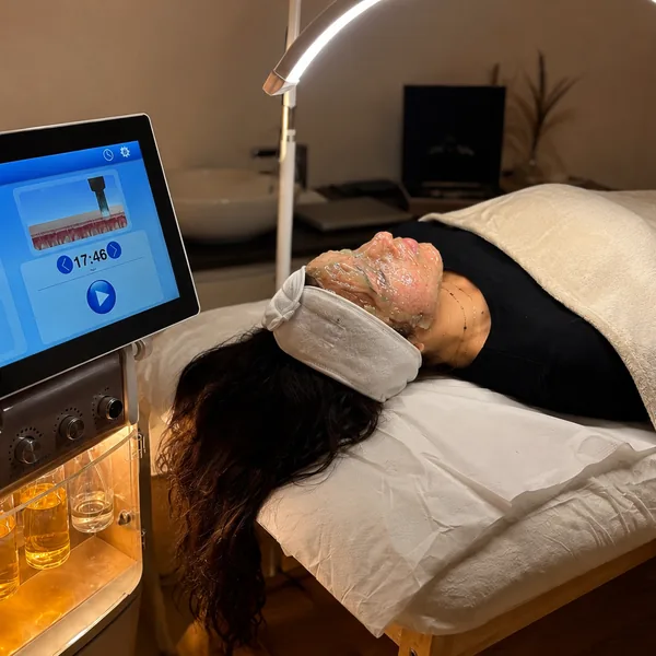 Diagnóstico facial con equipo de análisis de piel